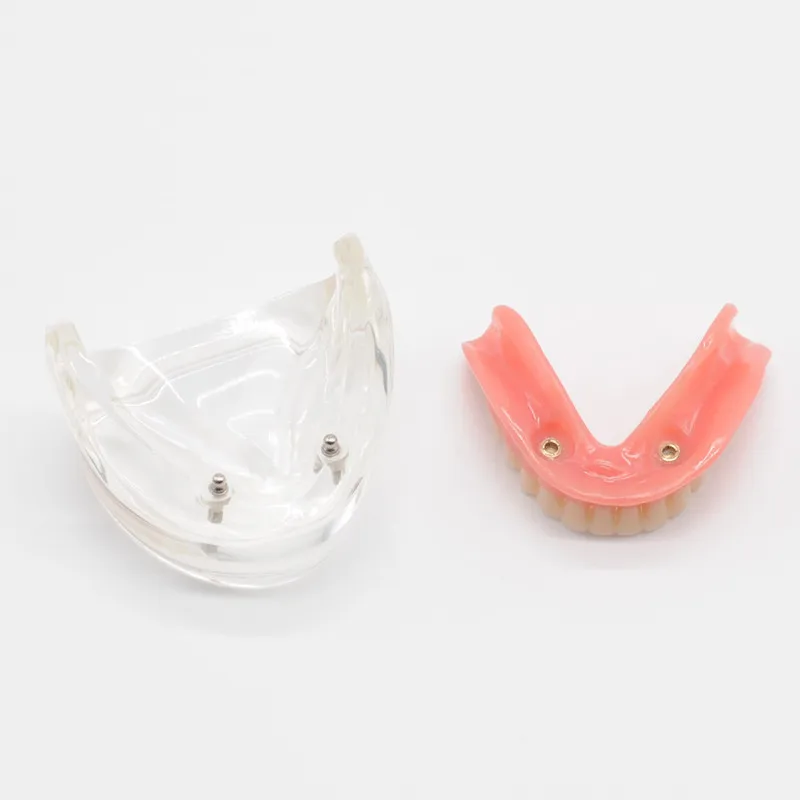 Нижняя челюсть с 2/4 имплантатами реставрация обучающая модель для стоматологического обучения - Цвет: 1pcs 2implants model
