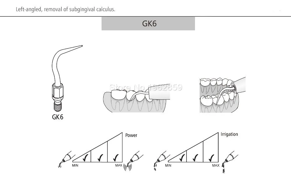 Dicas para Kavo Equipamentos de Ponta Compatível com Kavo Lote Dental Scaler Dentista Instrumento Ultra-sônica Gk1 Gk2 Gk3 Gk4 Gk5 Gk6 Gk7 7 Pçs - 7 High Quality Beleza e saúde