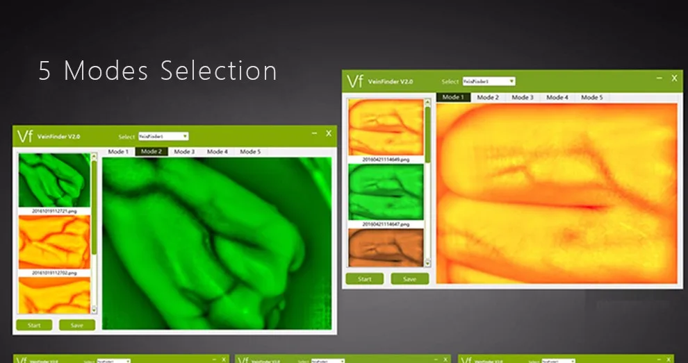 HD визуализирующий прибор для просмотра Вены, визуализирующий прибор для поиска вены, медицинский прибор для поиска вены, Usb интерфейс для взрослых и детей