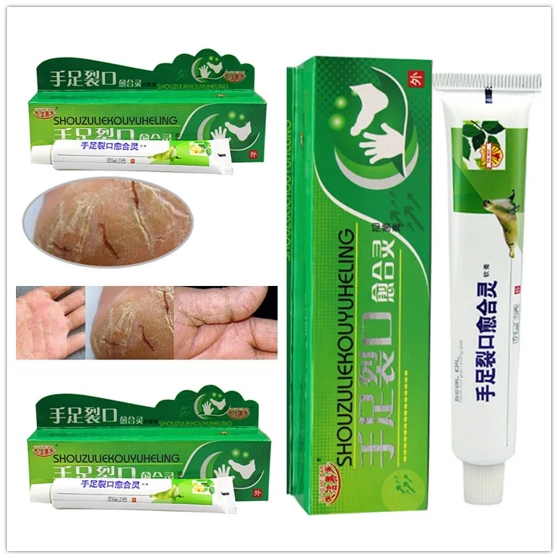 

Hand Foot Crack Repair Cream Heel Chapped Peeling Foot and Hand Repair Anti Dry Crack Skin Care Chinese Ointment