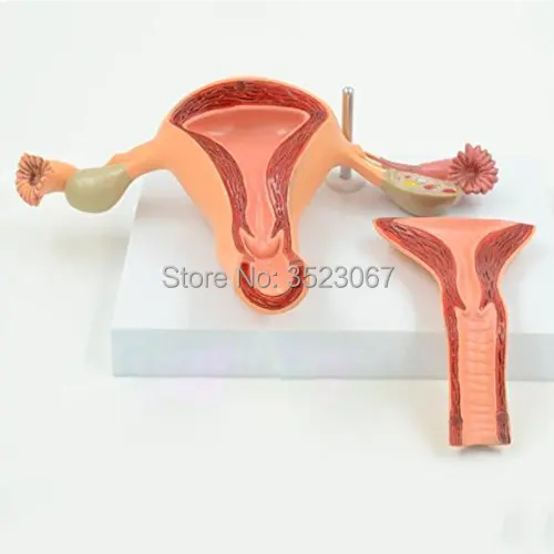 41ZdY6A42RL