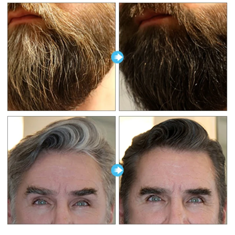 Выпрямление волос ремонт и выпрямление поврежденных волос продукты бразильский Кератиновый лечебный Борода волос