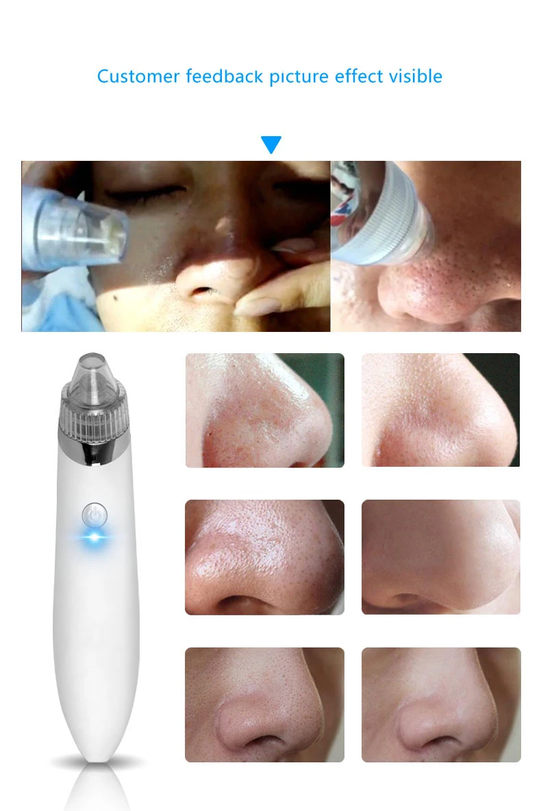 Blackhead-Vacuum-Extractor-Remover-Black-Head-Removal-Tool-Pore-Cleaner-Facial-Cleansing-Machine-Face-Skin-Care-Product-2018-New-arrivals (2)
