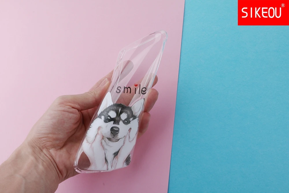 case for huawei P20 LITE case cover for huawei p20 pro case back cover silicon 360 full protective P 20 Lit Coque etui clear cat case for huawei P20 LITE case cover for huawei p20 pro case back cover silicon 360 full protective P 20 Lit Coque etui clear cat