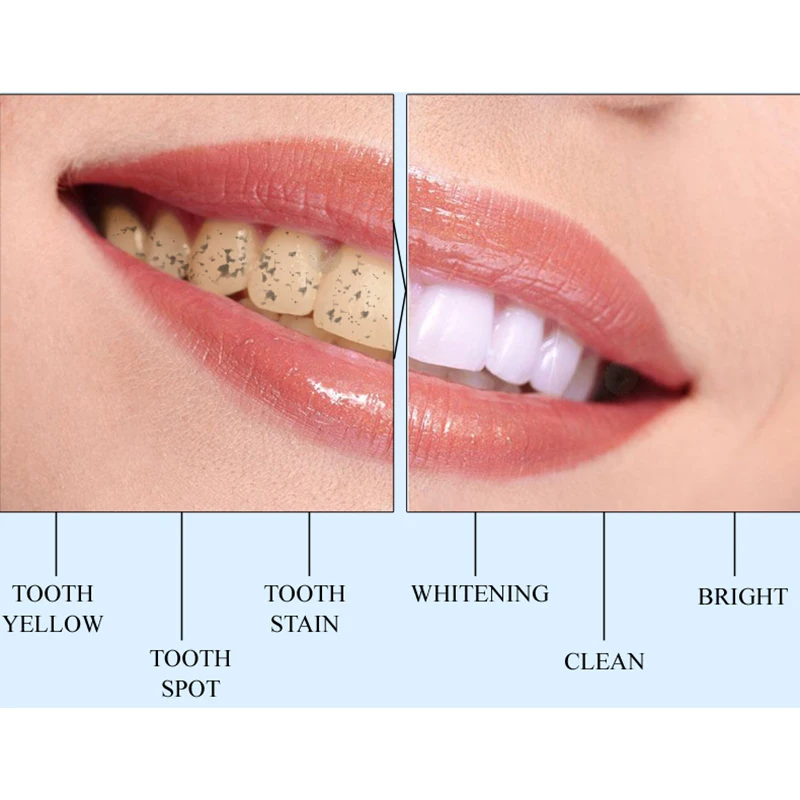 Профессиональная популярная белая отбеливающая ручка для зубов, зубной гель, отбеливатель для чистки полости рта, пятна для удаления зубных пятен, осветляющая ручка для отбеливания зубов, инструменты