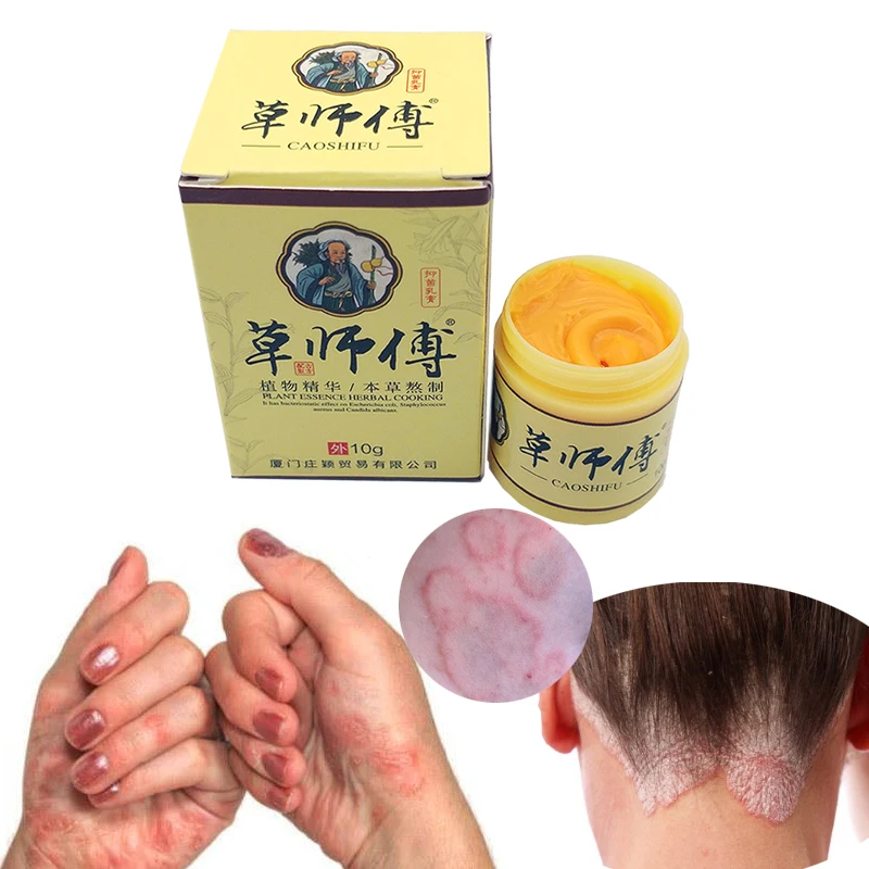 1 unidad de crema de Psoriasis Eczma funciona perfectamente para todo tipo de problemas de piel parche de cuerpo pomada para masaje medicina herbal china|Parches|   - AliExpress