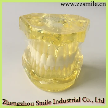 

Dental Soft Gum with Removable Teeth Without Hinge ModeL/Teeth Model M7006