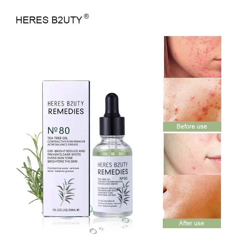 

HERES B2UTY 2019 Tea Tree seed moisturizing essence Facial essence Hydrating moisture Elite fluid soft&deep nourishing skin gel