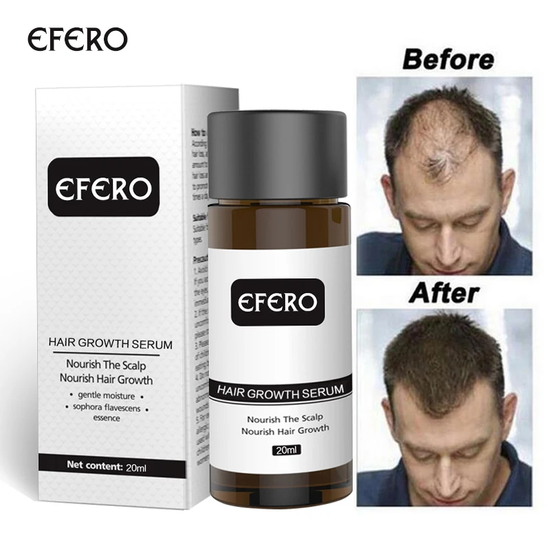 Hair Growth Essence Hair Loss Dense Hair Fast Hair Growth Grow Restoration Growing Serum Essential Oil