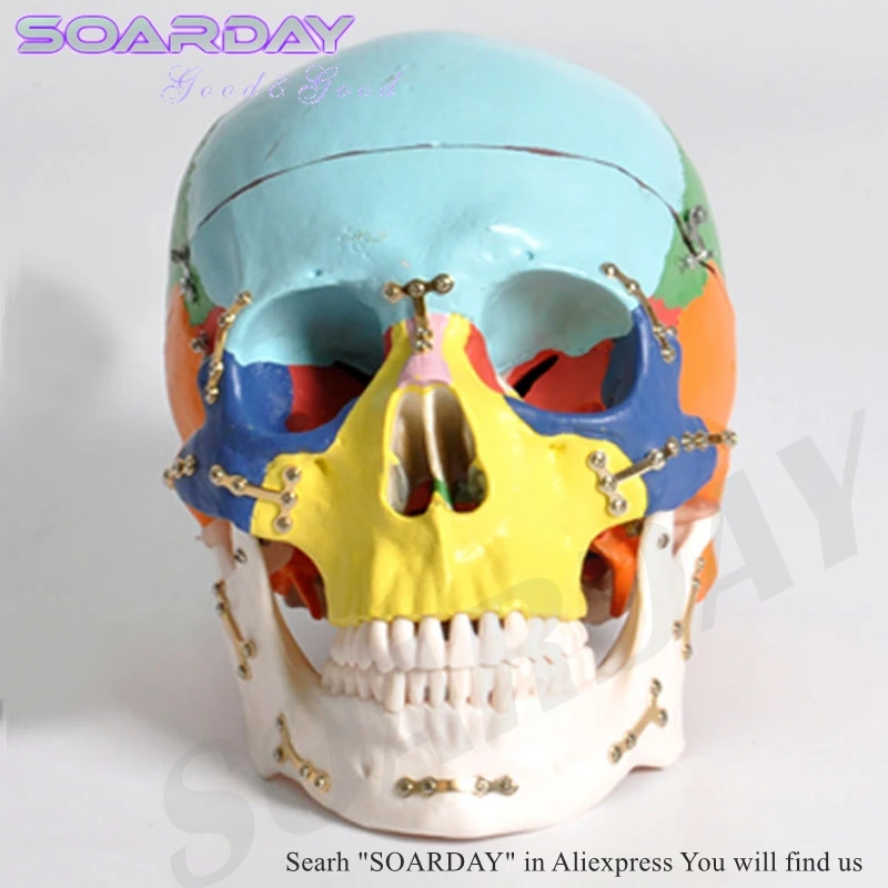 

SOARDAY Skull model with clolour Skull fractures fixed model hospital clinic doctor-patient communication simulation model