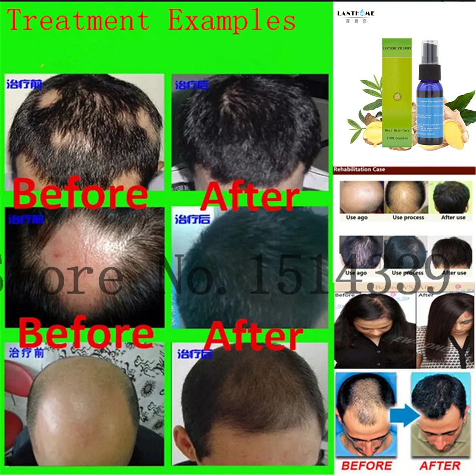 HTB1vxhxPVXXXXaWXpXXq6xXFXXXA