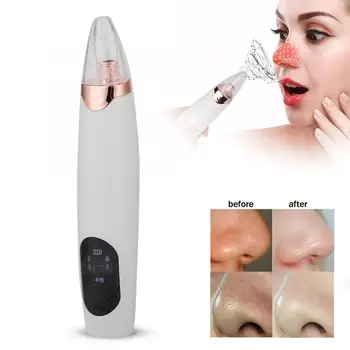 

Electronic Face Pore Cleaner Blackhead Removal Suction Machine Beauty Device n