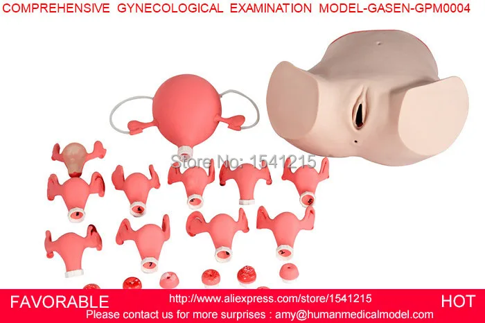 GYNECOLOGICAL TRAINING SIMULATOR, GYNECOLOGICAL EXAMINATION MODEL,COMPREHENSIVE GYNECOLOGICAL EXAMINATION MODEL-GASEN-GPM0004 peritoneal dialysis simulator model