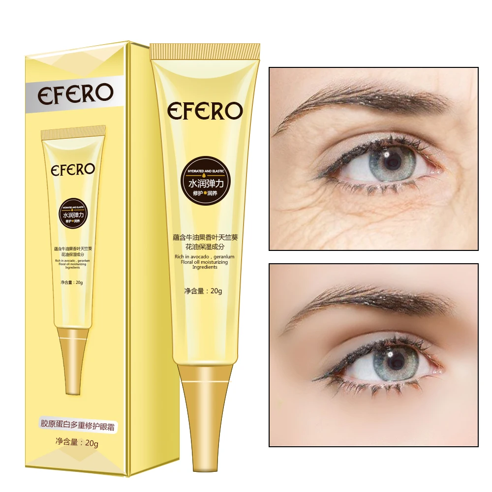 eye cream to remove dark circles