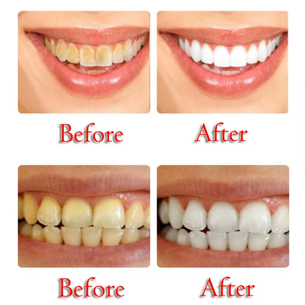 220g-Passion-Fruit-Blueberry-Toothpaste-Stain-Removal-Whitening-Baking-Soda-Toothpaste-Fight-Bleeding-Gums-Toothpaste (3)