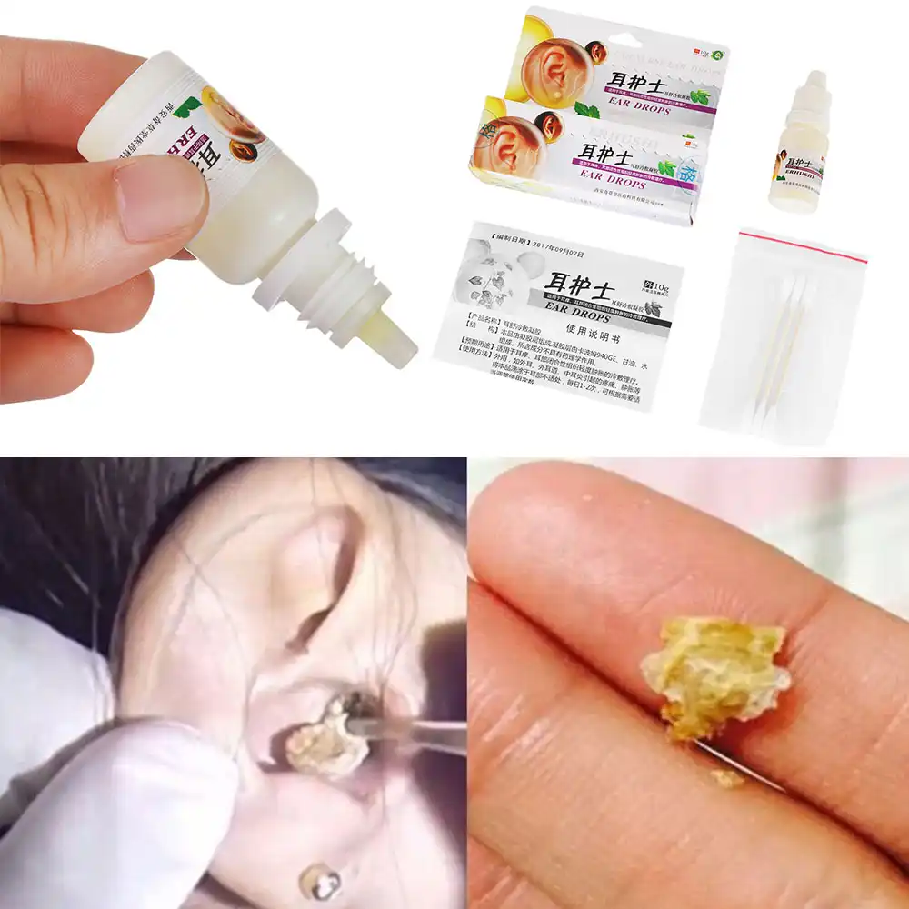 15 мл/бутылка жидкость для уха острый отит капель китайская травяная медицина для ушной тиннитус глухость больная забота о здоровье