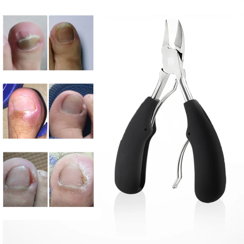 Профессиональные кусачки для ногтей ног резак Кусачки Chiropody сверхмощные толстые гвозди из нержавеющей стали материал бытовые изделия