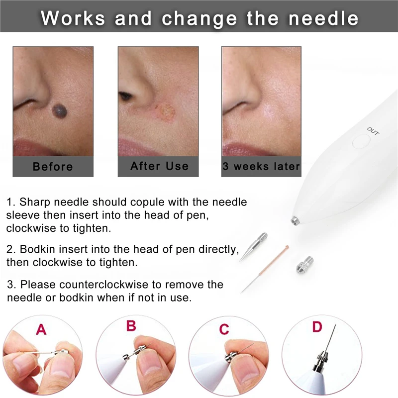 Забота о здоровье кожи, точечная ручка для удаления молей, темное USB зарядное устройство для удаления пятен, ручка для удаления кожных бородавок, инструмент для удаления татуировок, косметический уход, розовое золото