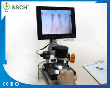 

Nailfold Capillary Microscopy Color Microcirculation Microscope video microcirculation microscope
