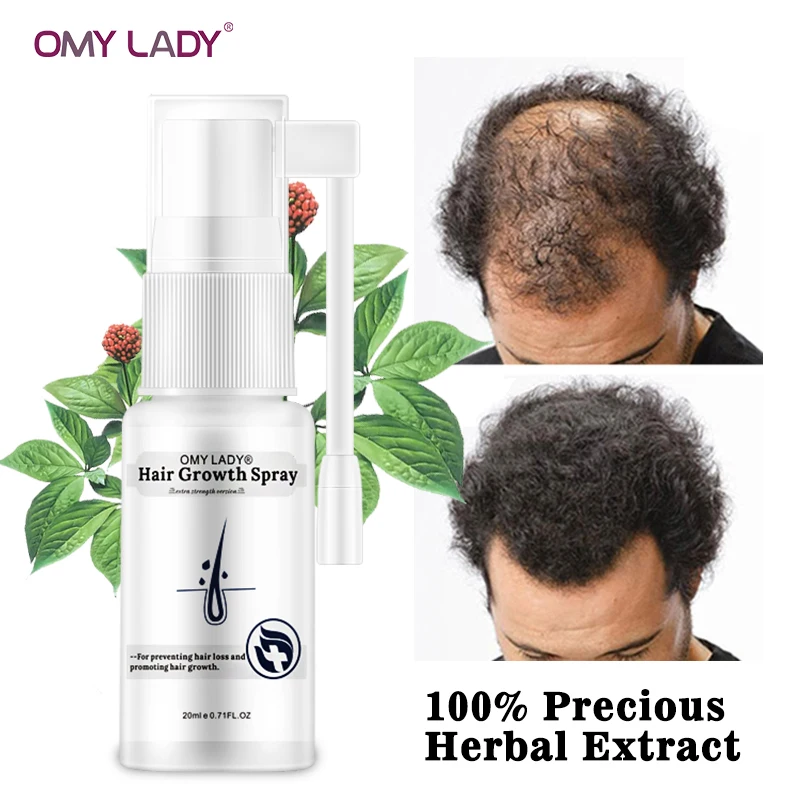 OMYLADY Anti Hair Loss Liquid Hair Growth Spray Essential Oil For Dry Hair Regeneration Repair Moisturizing Hair Care Products OMYLADY Anti Hair Loss Liquid Hair Growth Spray Essential Oil For Dry Hair Regeneration Repair Moisturizing Hair Care Products