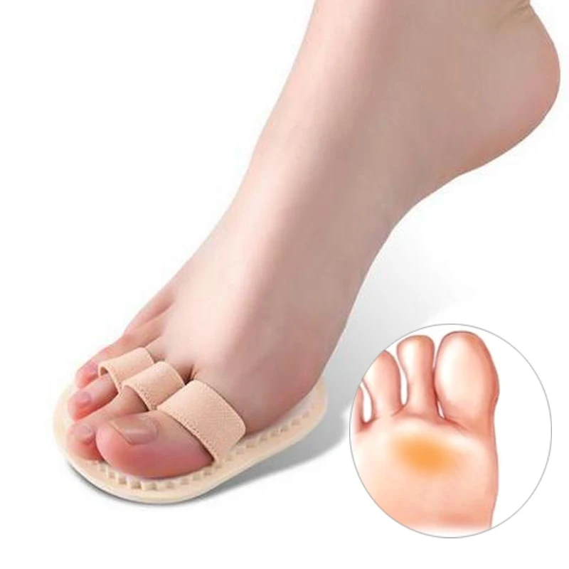 3 пальца стопы носки вкладыши колодки молоток палец сепаратор для вальгусной деформации ортеза изгиб деформации Наложение коррекция носка