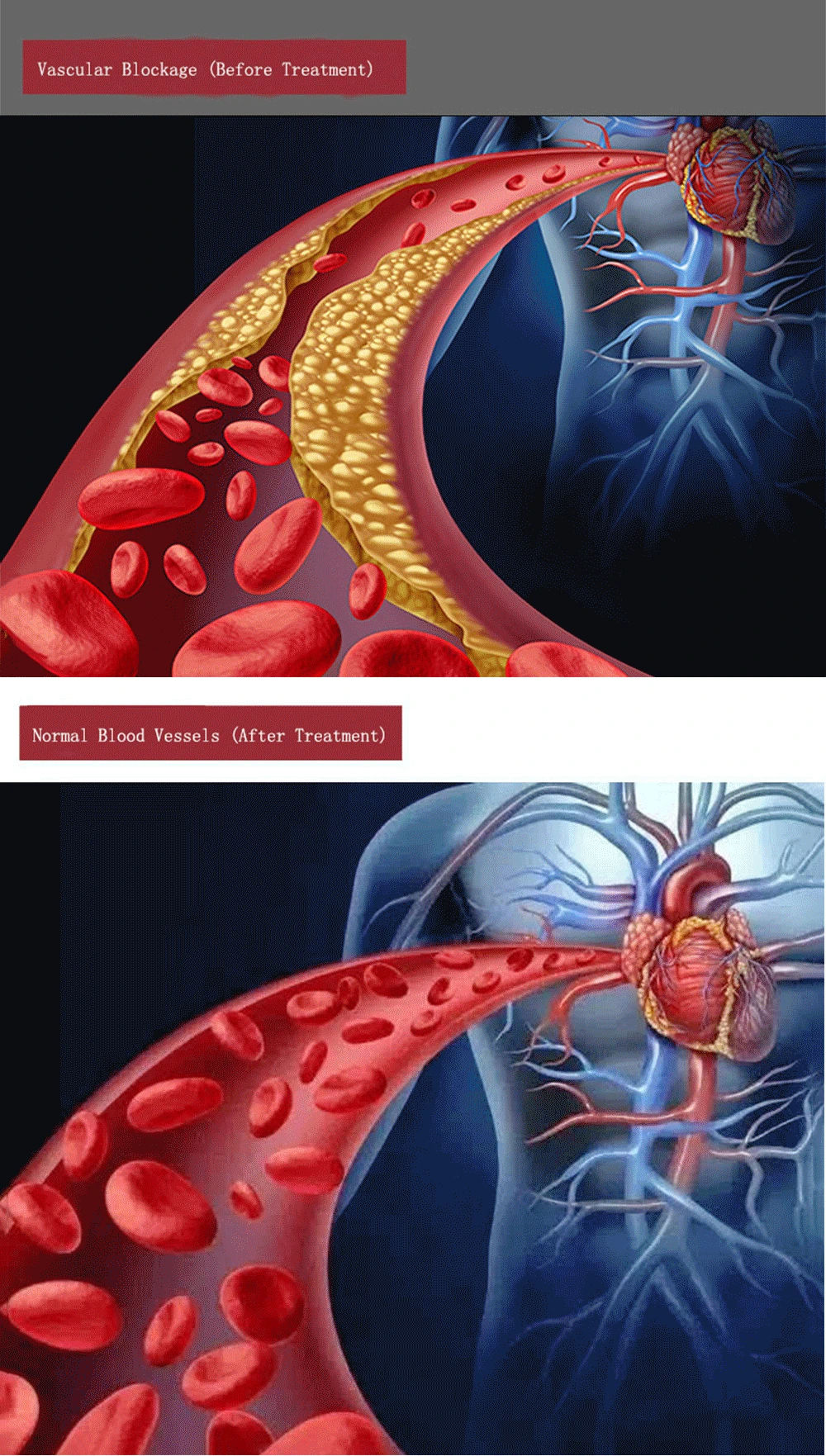 Vermelho Laser Relógio Tratamento Dor Crônica Insônia Aliviar Tensões Diabetes Instrumento Terapêutico 650nm 13 insônia aliviar tensões diabetes instrumento terapêutico
