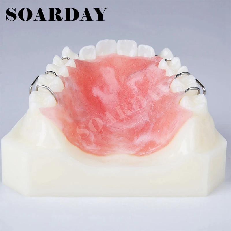 Dental Retainer Demonstration Model Orthodontics Treatment Model  (5)