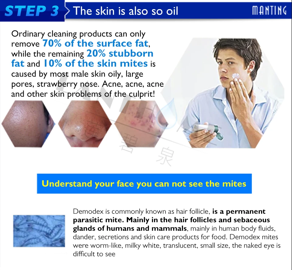 Уход за кожей и лицом от акне крем для удаления клещей средство по уходу за лицом от прыщей лечение шрамов и грибка мыло для тела