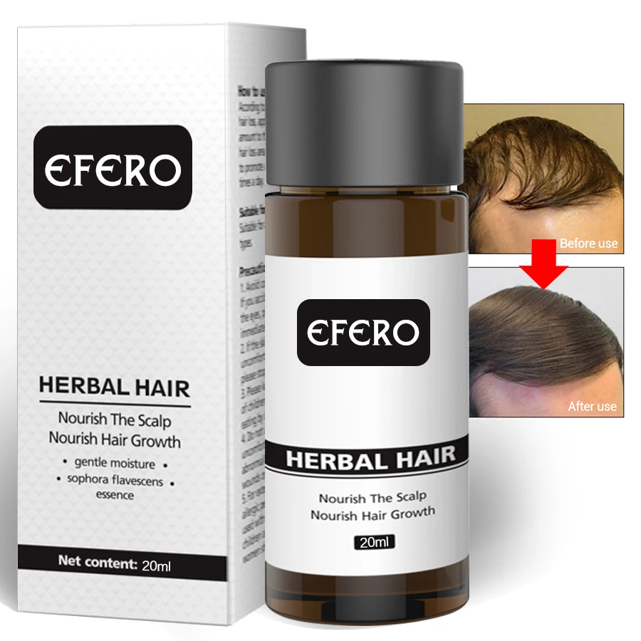 EFERO Hair Growth Essence Oil Hair Beard Growth Serum Anti-hair Loss Products Hairs Care Treatment Essential for Women Men 20ML EFERO Hair Growth Essence Oil Hair Beard Growth Serum Anti-hair Loss Products Hairs Care Treatment Essential for Women Men 20ML