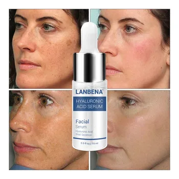 

2018 LANBENA Hyaluronic Acid Serum Snail Essence Facial Cream Moisturizing Acne Treatment Skin Care Repair Whitening Anti-Aning