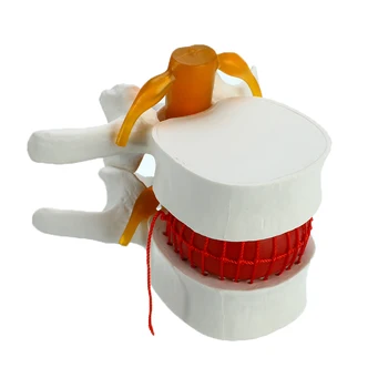

Human Anatomy Skeleton Spine Lumbar Disc Herniation Teaching Model Brain skull traumatic pistol school supplies medical instrume