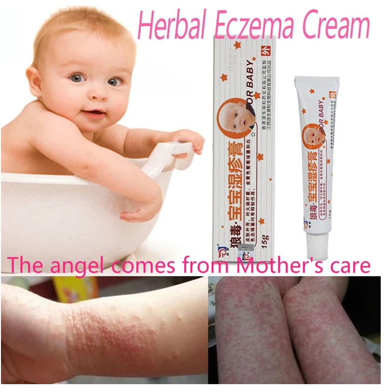 Baby Traditional Medicine Eczema Cream For Children s Skin External Use Of Anti Antibacterial Chinese Herbal
