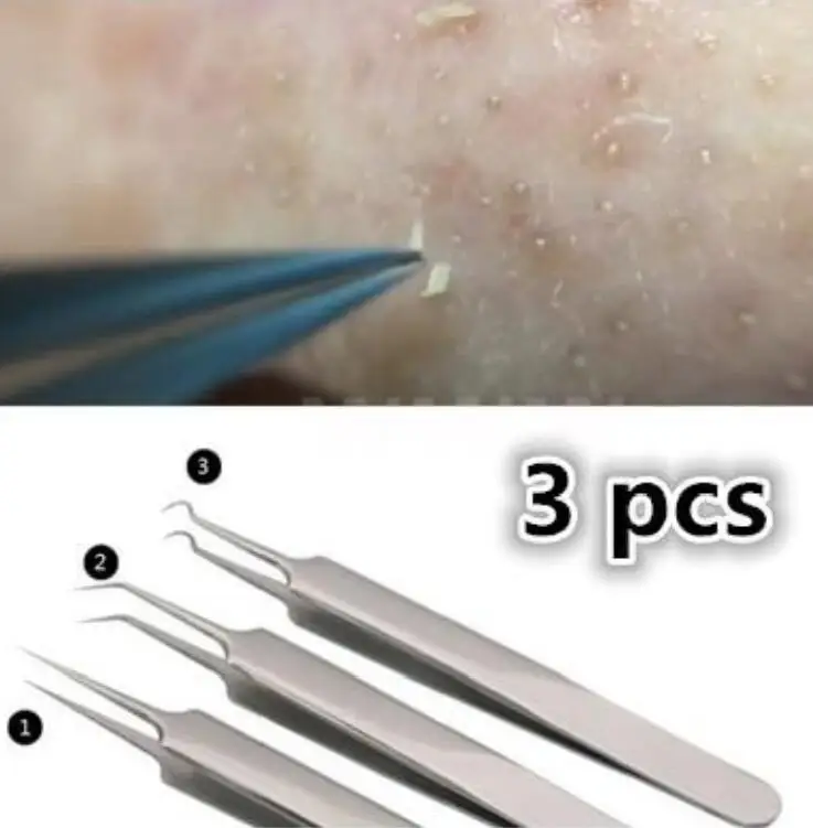 

Stainless Steel Blackhead Remover Acne Needle Tweezers Blackhead Extractor for Pimple Blemish Comedone Acne Spots Remover Kit