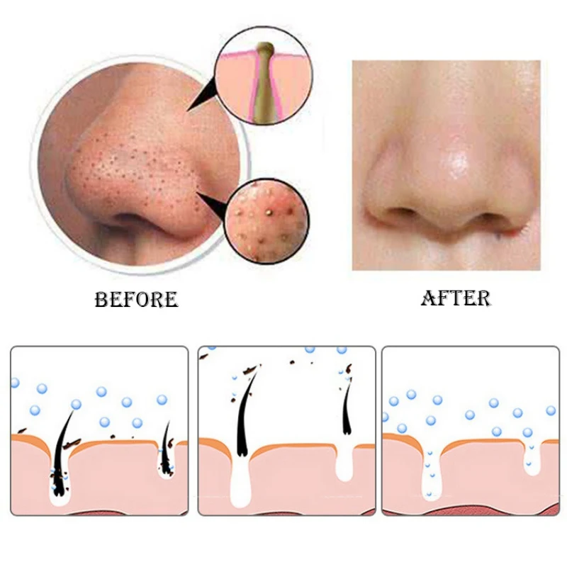 24K Gold Facial Treatment Tearing Gold Pore Removal Cleansing Deep