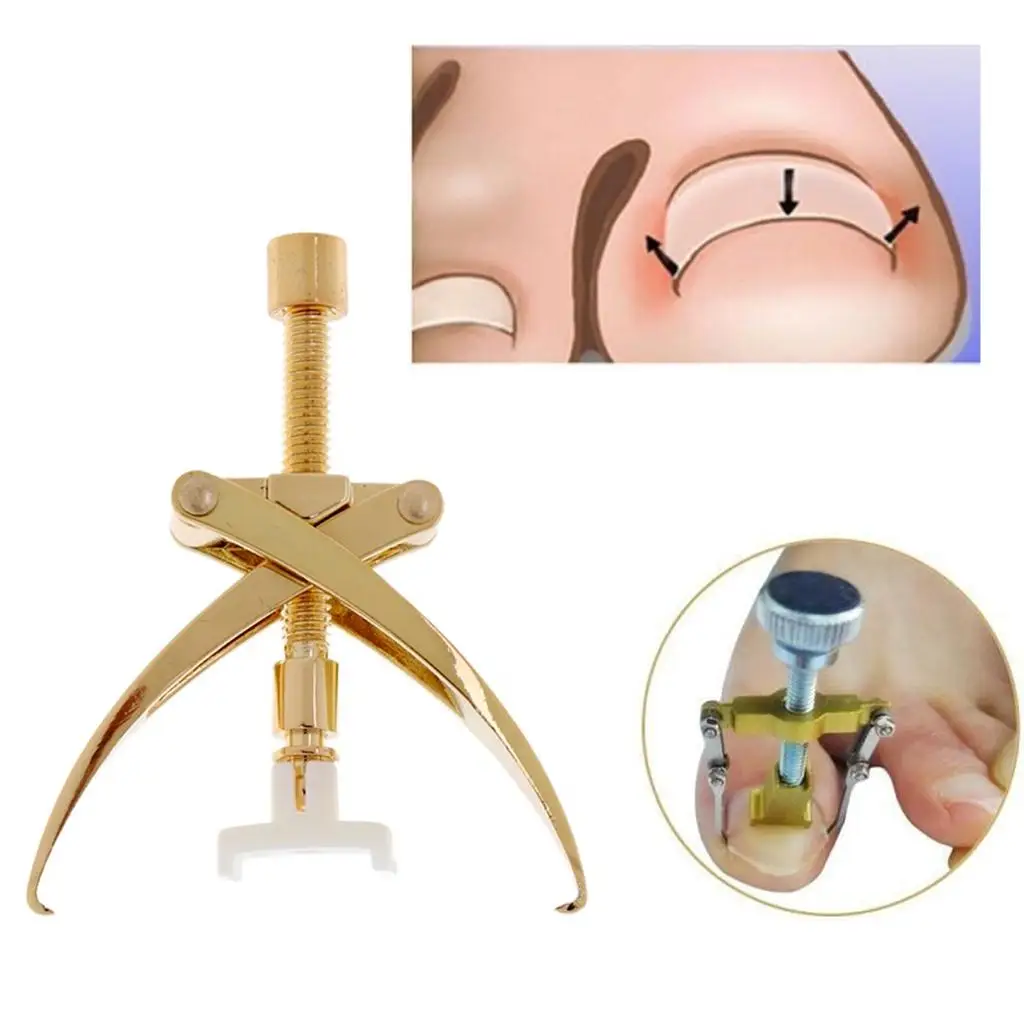 Ingrown Toenail Correction Tool Manicure Clipper Pedicure Fixer Recover Tool Teen Nail Correctie Tools