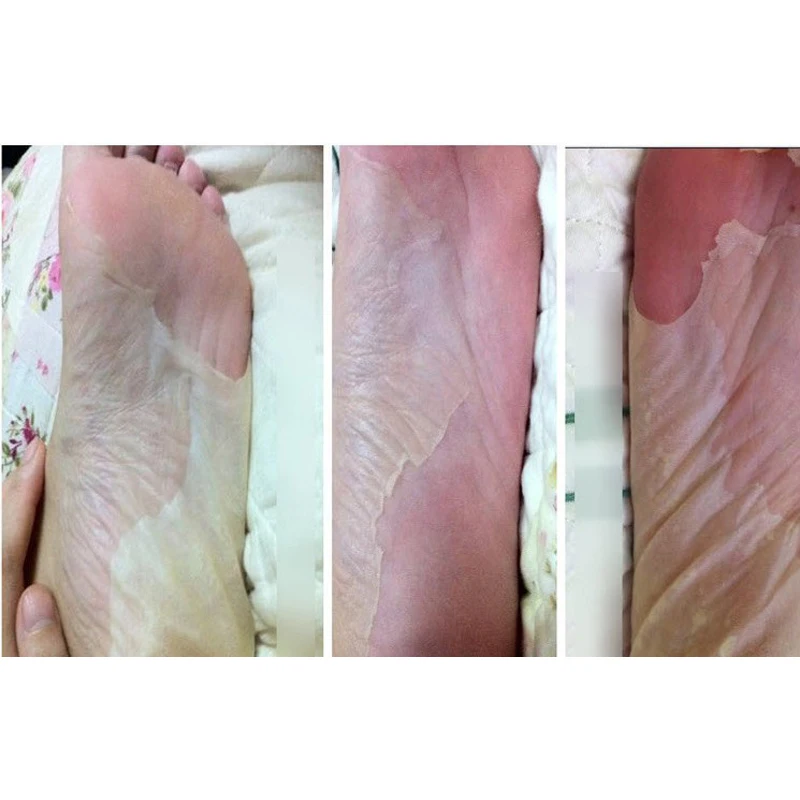 Efero 4 пары Отшелушивающий для ног разглаживающий отбеливающий маска для ног носок для педикюра детские ножки пилинг мертвая кожа отшелушивающий уход за кожей ног