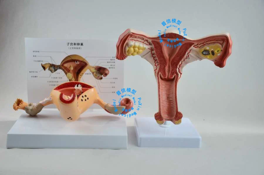 Freies Verschiffen Die Pathologischen Modell Der Gebarmutter Gebarmutter Anatomie Genital Orgel Dissect Modell Lehre Fur Medizinische For Medical Genital Organsuterus Model Aliexpress