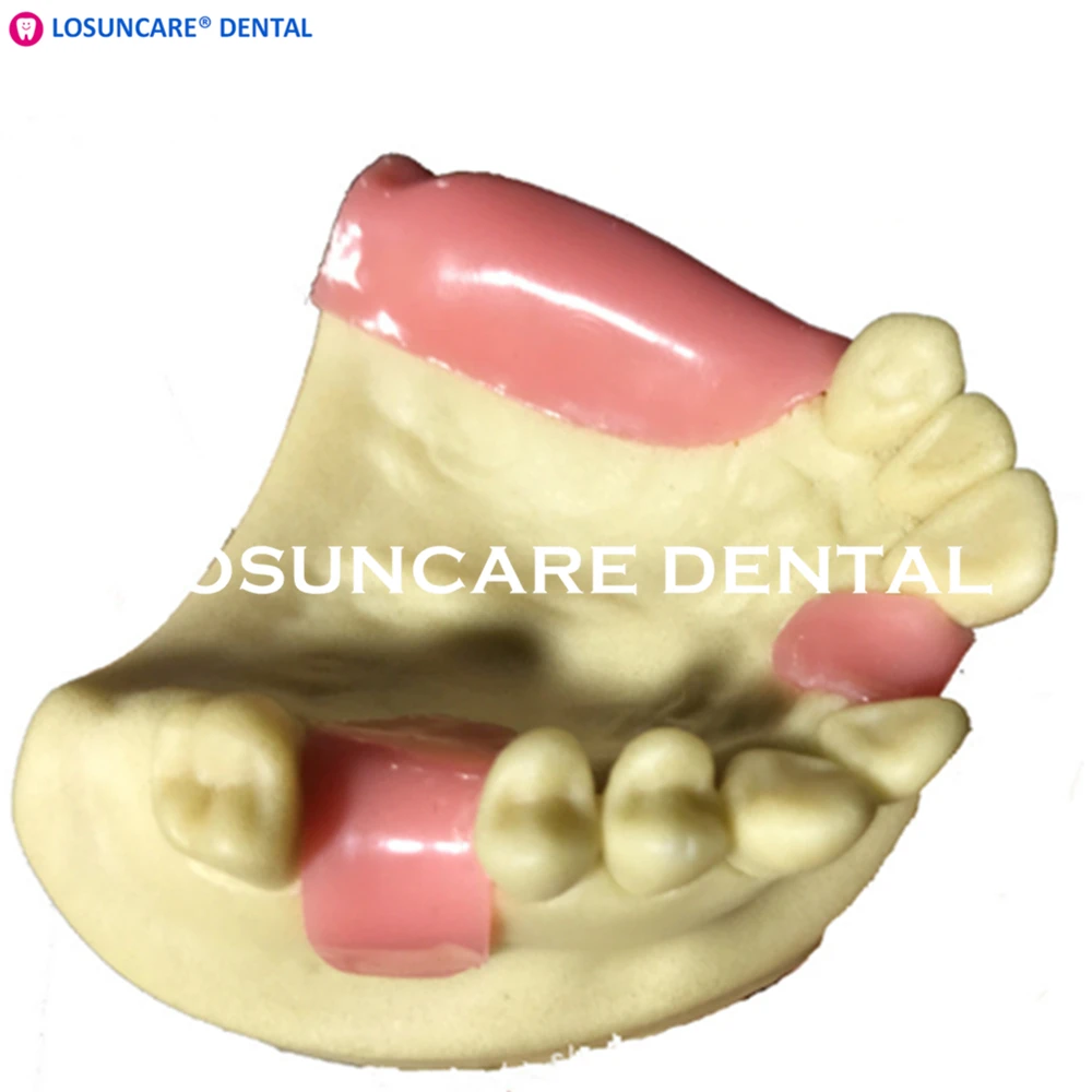 Стоматологическая Синусоидальная подъемная модель зубов типодонт Учебная модель для тренировки имплантации модель для обучения