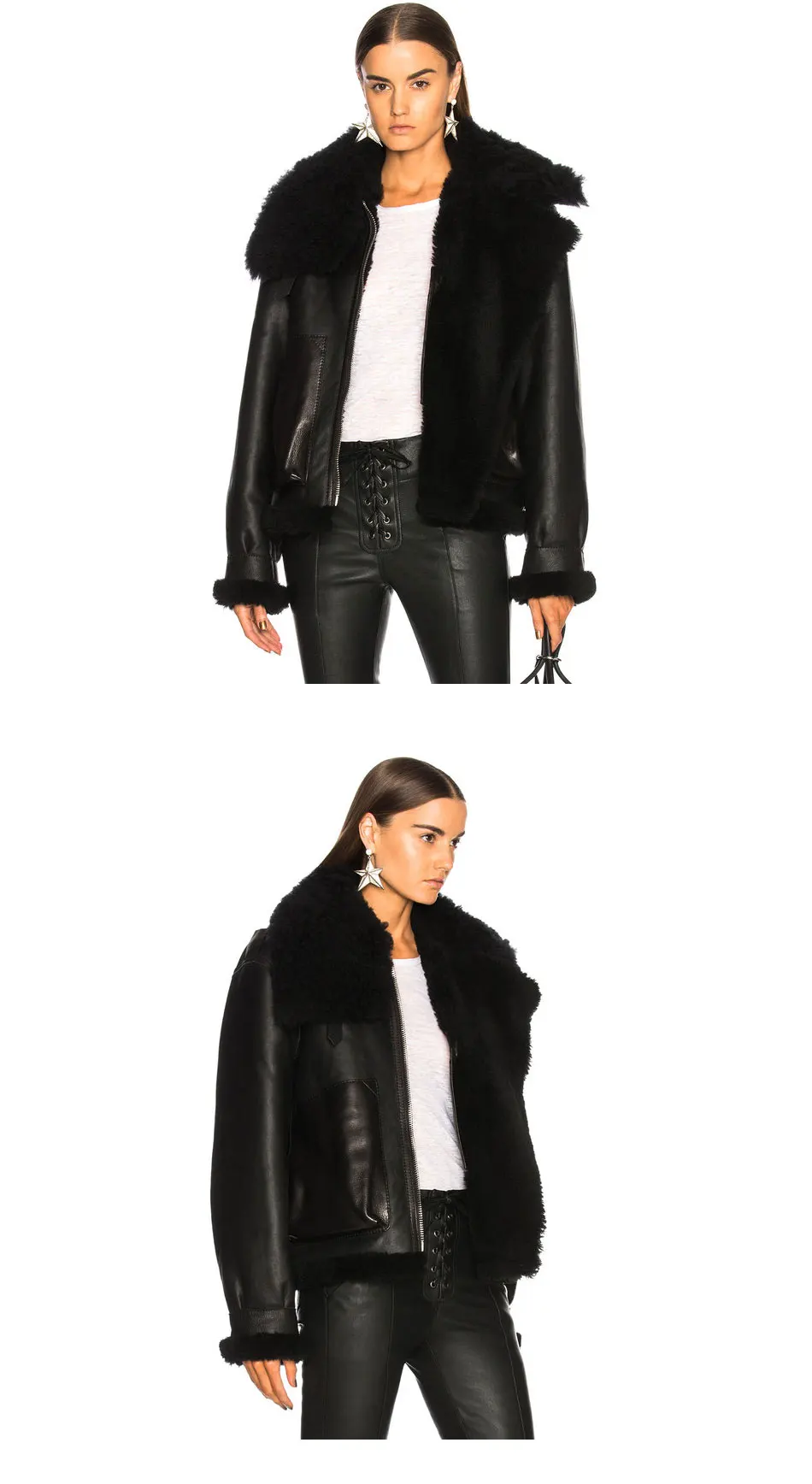 ACNE_09