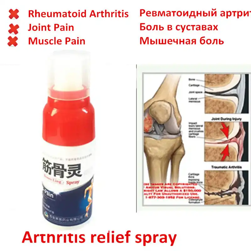 Bones Ling Pain Relief Spray Rheumatism Arthritis Muscle Sprain Knee Waist Pain Back Shoulder Spray Tiger Orthopedic Plaster Patches Aliexpress