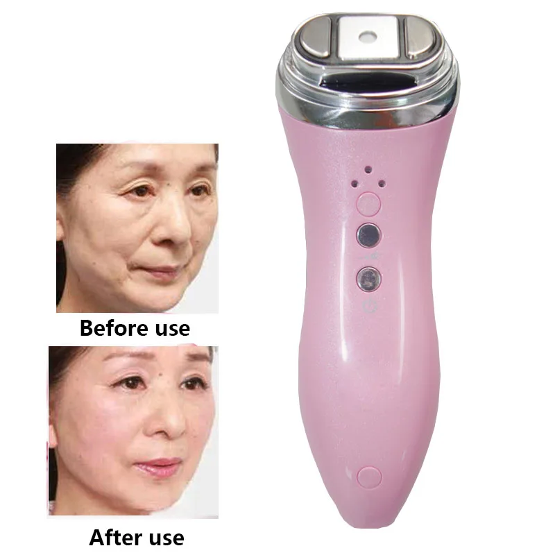 Mini HIFU Ultrasonic RF Antiaging Skin Lifting Facial Care