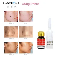 2 Sets Freckle Remove Oil Little Moles Warts Eye Body Skin Mole Skin Tag Repair Wart Remover Solution Painless Essence Face Tool