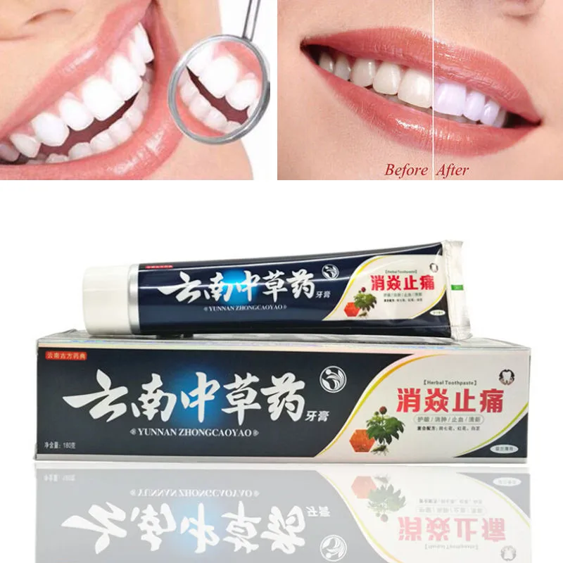 Зубная паста Юньнань байяо 180 отбеливающая зубная паста|yunnan baiyao toothpaste|black