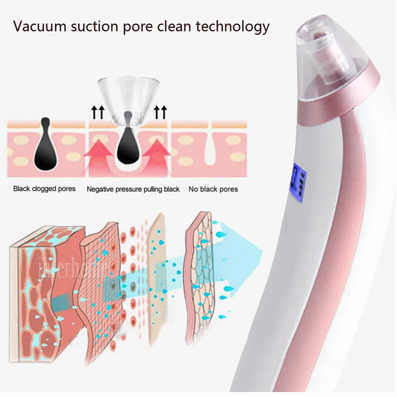 Blackhead-Remover-0899-2(4)