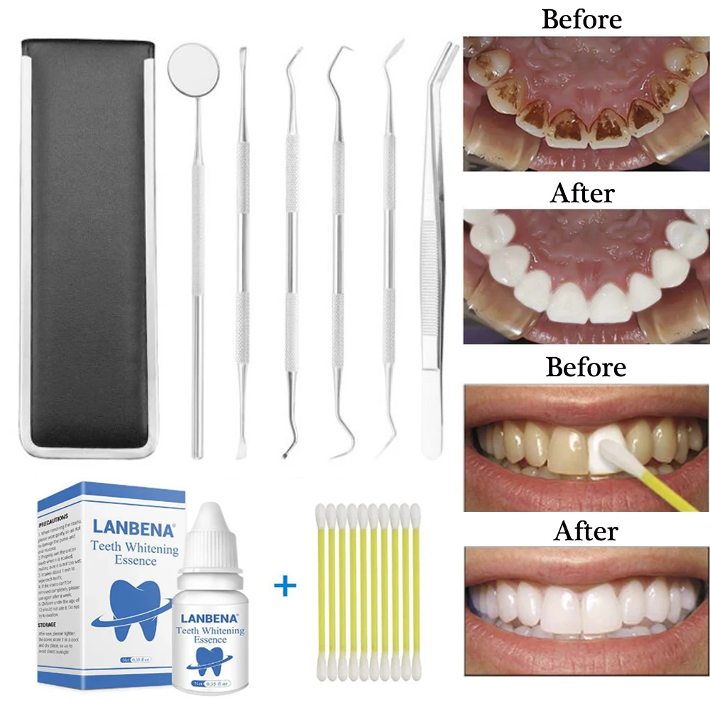 Dental Mirror Stainless Steel Dental Dentist cleaning Tool Teeth