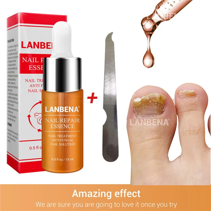 Order Chance for  Foot Nail Care Treatment Bright Fungal Nail Repair Onychomycosis Removal Essence Foot Care Anti Inf