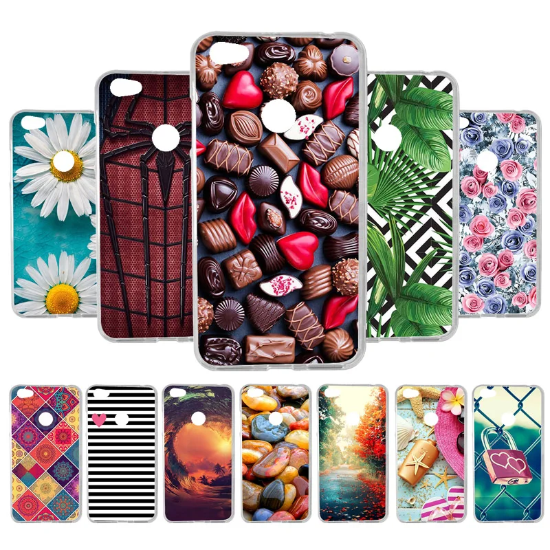 

Vanveet Case For Xiaomi Redmi Note 5A Prime Pro Case Coque For Xiaomi Redmi Note5A Prime Pro Cases Soft Back Covers Fundas Coque
