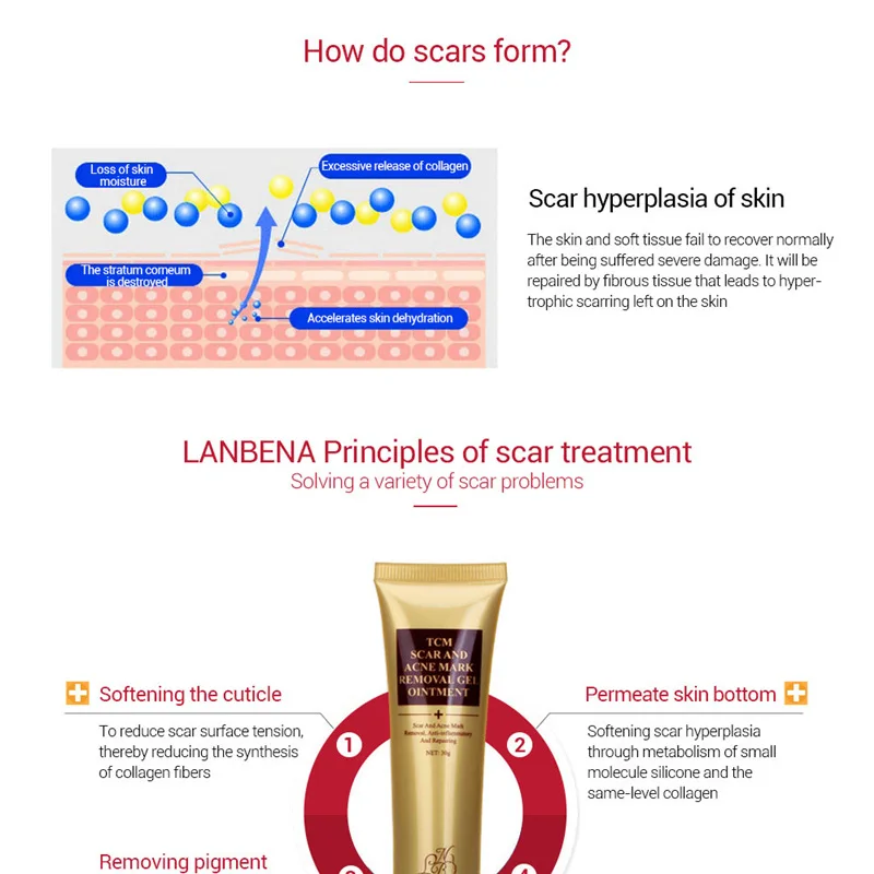 LANBENA Удаление Шрама от акне Кожи Крем восстанавливающий крем для лица акне пятна лечение акне отбеливание чёрных точек крем стрейч Знаки 30 мл