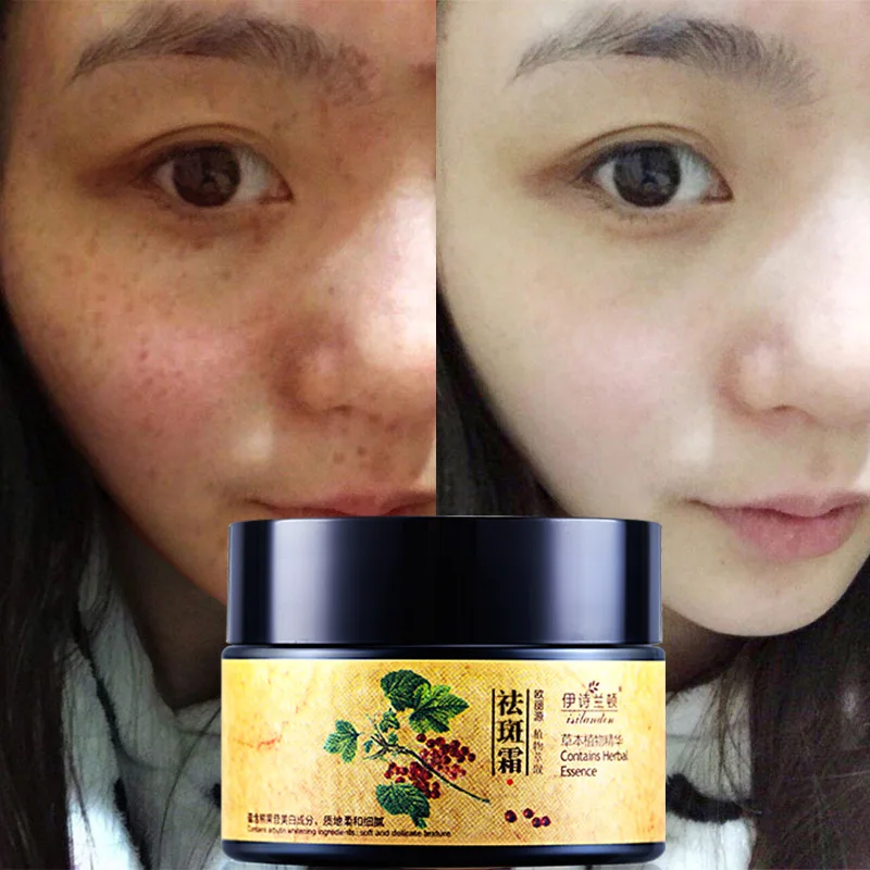 

ISILANDON Face Care Cream Herbs Freckle Removal Cream Remove Fade Dark Spots Whitening Cream Skin Care Speckle Free Shipping NEW