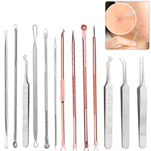 Stainless Steel Blackhead Acne Remover Needle Tool Kit Blackhead Acne Comedone Pimple Blemish Extractor Beauty Tool Face Care Stainless Steel Blackhead Acne Remover Needle Tool Kit Blackhead Acne Comedone Pimple Blemish Extractor Beauty Tool Face Care
